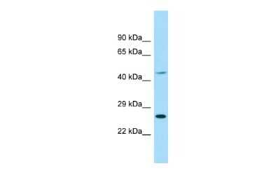 Western Blot: EIF4E1B Antibody [NBP2-82986]