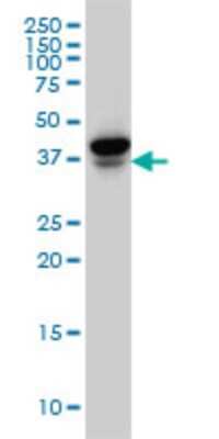 Western Blot: EIF4E2 Antibody (1A11) [H00009470-M02]