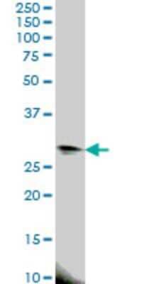 Western Blot: EIF4E2 Antibody (4G10) [H00009470-M01]