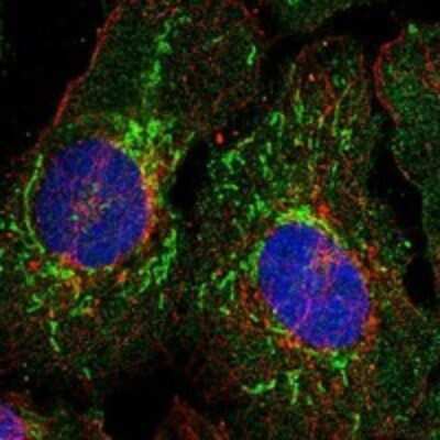 Immunocytochemistry/ Immunofluorescence: EIF4E2 Antibody [NBP3-17839]