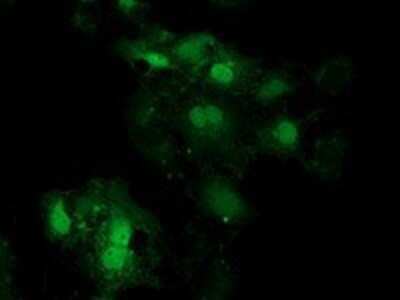 Immunocytochemistry/ Immunofluorescence: EIF4E2 Antibody (OTI1F11) - Azide and BSA Free [NBP2-71468]