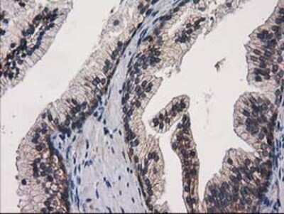 Immunohistochemistry: EIF4E2 Antibody (OTI1F11) - Azide and BSA Free [NBP2-71468]