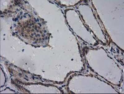 Immunohistochemistry: EIF4E2 Antibody (OTI1F11) - Azide and BSA Free [NBP2-71468]