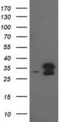 Western Blot: EIF4E2 Antibody (OTI1F11)Azide and BSA Free [NBP2-71468]