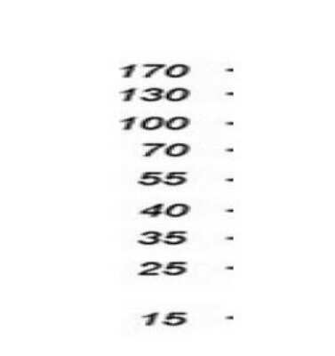 Western Blot: EIF4E2 Antibody (OTI1F11) [NBP2-03611]