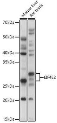 Western Blot: EIF4E2 AntibodyAzide and BSA Free [NBP3-04559]