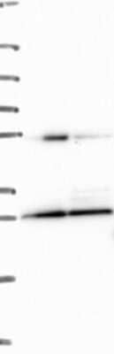 Western Blot: EIF4E2 Antibody [NBP3-17839]