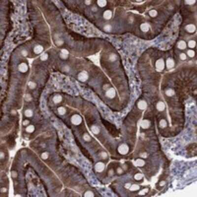 Immunohistochemistry-Paraffin: EIF4E3 Antibody [NBP3-17244]