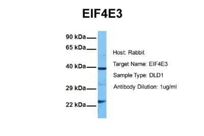 Western Blot: EIF4E3 Antibody [NBP2-82987]