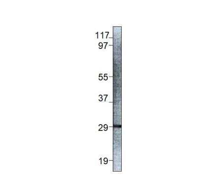 Western Blot: EIF4E3 Antibody [NBP3-12463]