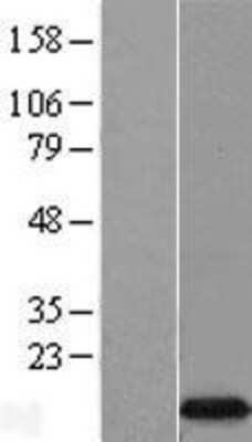 Western Blot: EIF4EBP3 Overexpression Lysate [NBL1-10208]