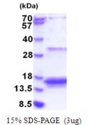 SDS-PAGE: Recombinant Human EIF4EBP3 His Protein [NBP2-51784]