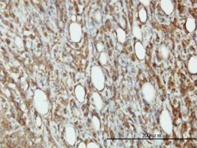 Immunohistochemistry-Paraffin: EIF5 Antibody (2E6-4C12) [H00001983-M01]