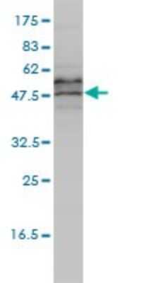 Western Blot: EIF5 Antibody (2E6-4C12) [H00001983-M01]