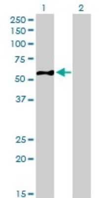 Western Blot: EIF5 Antibody (2E6-4C12) [H00001983-M01]