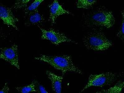 Immunocytochemistry/ Immunofluorescence: EIF5 Antibody [NBP3-00231]