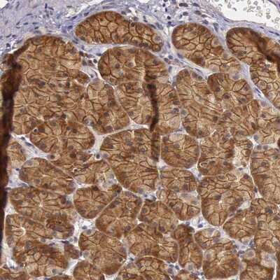 Immunohistochemistry-Paraffin: EIF5 Antibody [NBP1-86184]
