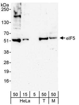 Western Blot: EIF5 Antibody [NB100-93312]