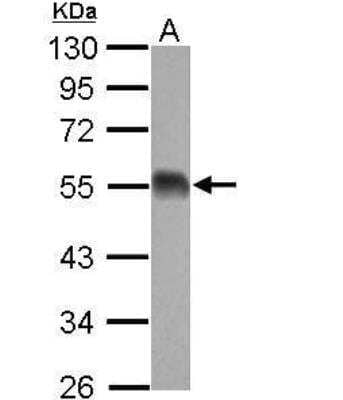 Western Blot: EIF5 Antibody [NBP2-16311]