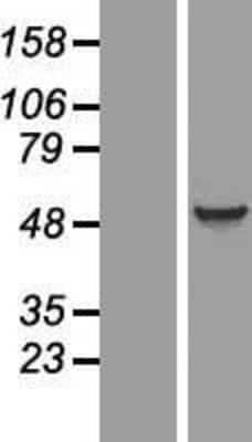 Western Blot: EIF5 Overexpression Lysate [NBP2-10063]