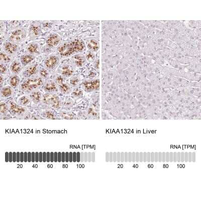 Immunohistochemistry-Paraffin: EIG121 Antibody [NBP1-90479]