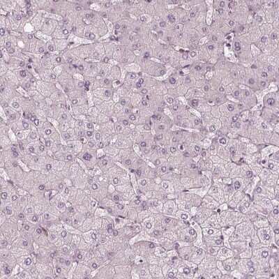 Immunohistochemistry-Paraffin: EIG121 Antibody [NBP2-57699]