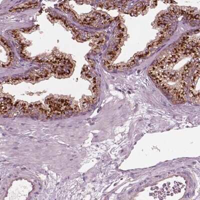 Immunohistochemistry-Paraffin: EIG121 Antibody [NBP2-57699]