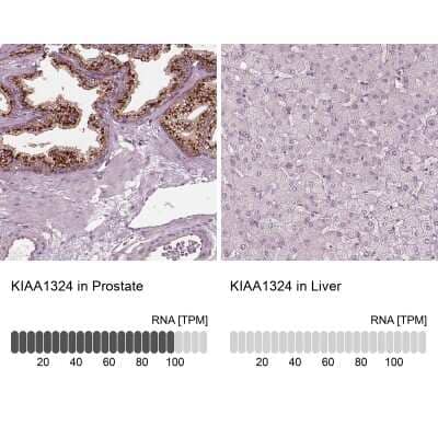 Immunohistochemistry-Paraffin: EIG121 Antibody [NBP2-57699]