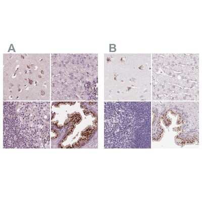 Immunohistochemistry-Paraffin: EIG121 Antibody [NBP2-57699]