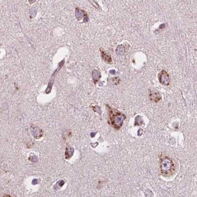 Immunohistochemistry-Paraffin: EIG121 Antibody [NBP2-57699]