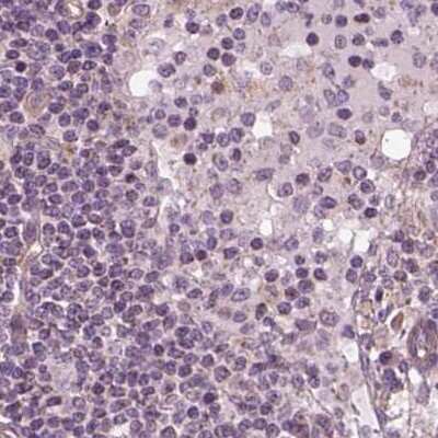 Immunohistochemistry-Paraffin: EIG121 Antibody [NBP2-57699]