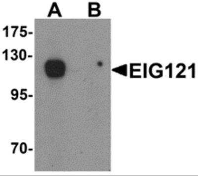 Western Blot: EIG121 AntibodyBSA Free [NBP2-81949]