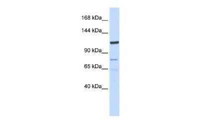 Western Blot: EIG121 Antibody [NBP2-84846]