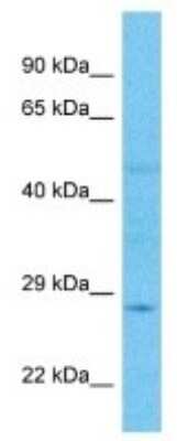 Western Blot: ELA2A Antibody [NBP3-10646]