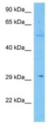 Western Blot: ELA2A Antibody [NBP3-10828]