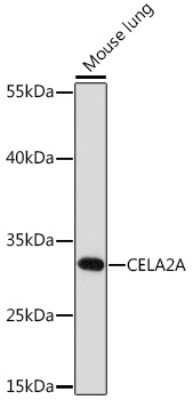 Western Blot: ELA2A AntibodyAzide and BSA Free [NBP3-15533]