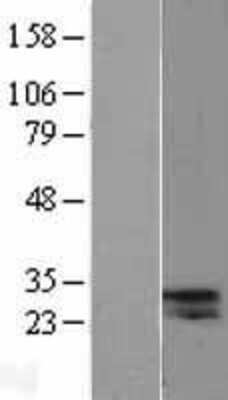 Western Blot: ELA2A Overexpression Lysate [NBL1-10218]