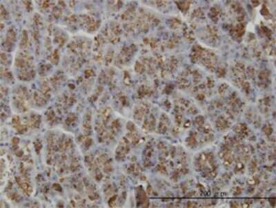 Immunohistochemistry-Paraffin: ELA3A Antibody (3G4) [H00010136-M02]