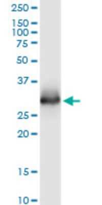 Western Blot: ELA3A Antibody (3G4) [H00010136-M02]