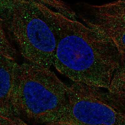 Immunocytochemistry/ Immunofluorescence: ELA3A Antibody [NBP2-58716]