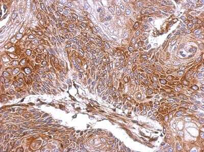 Immunohistochemistry-Paraffin: ELA3A Antibody [NBP2-14946]