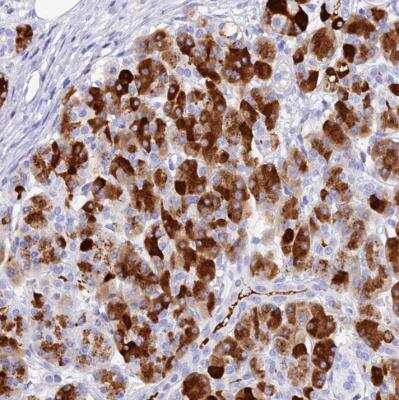 Immunohistochemistry-Paraffin: ELA3A Antibody [NBP2-54725]