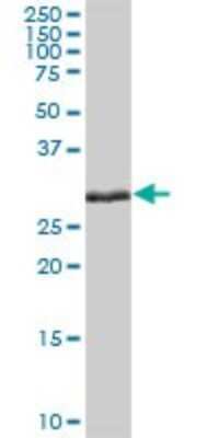 Western Blot: ELA3A Antibody [H00010136-B01P]