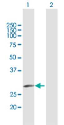 Western Blot: ELA3A Antibody [H00010136-B01P]