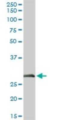 Western Blot: ELA3A Antibody [H00010136-D01P]