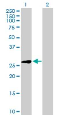 Western Blot: ELA3A Antibody [H00010136-D01P]