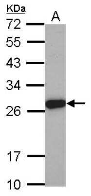 Western Blot: ELA3A Antibody [NBP2-14946]