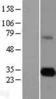 Western Blot: ELA3A Overexpression Lysate [NBL1-10220]