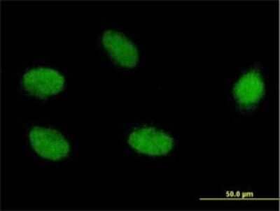 Immunocytochemistry/ Immunofluorescence: ELAC2 Antibody (1A2) [H00060528-M01]