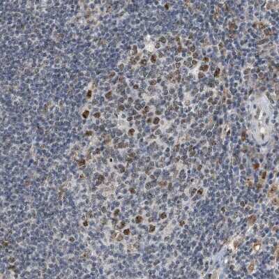 Immunohistochemistry-Paraffin: ELAC2 Antibody [NBP1-84620]